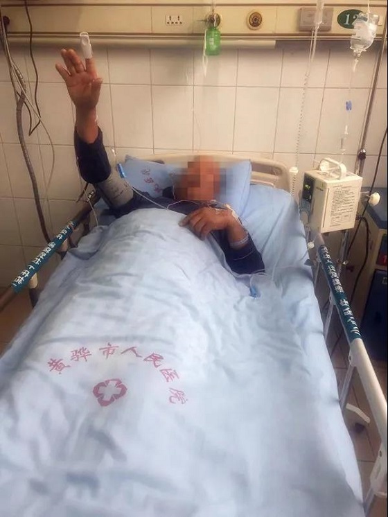 【医心为民解危难 团队妙手除偏瘫】黄骅市人民医院神经内科及时救治一脑内大动脉血栓病人